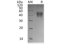 Recombinant Human IL-21R Protein (His Tag) – Figure 1 of 2