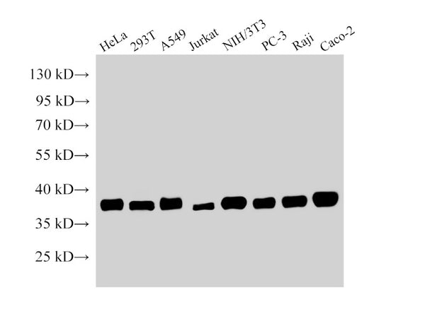 NPM1 Polyclonal Antibody – Figure 1 of 4