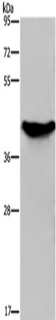 GALK1 Polyclonal Antibody – Figure 1 of 4