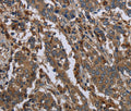 GYS2 Polyclonal Antibody – Figure 1 of 3