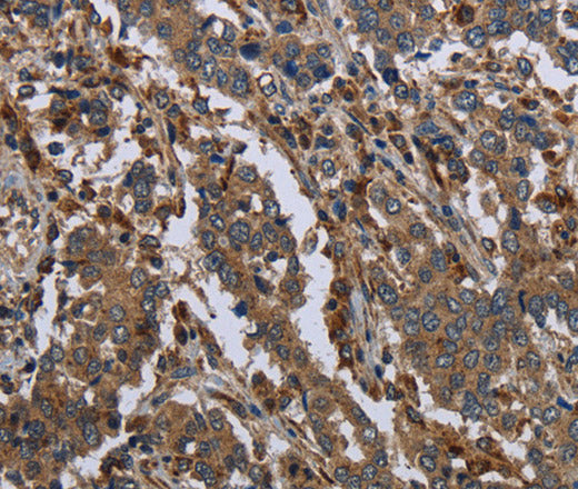 GYS2 Polyclonal Antibody – Figure 1 of 3