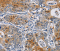GSTA2 Polyclonal Antibody – Figure 1 of 2