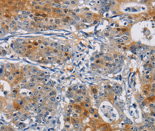 GSTA2 Polyclonal Antibody – Figure 1 of 2