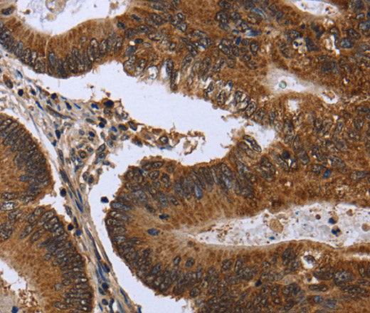 FGFR1OP Polyclonal Antibody – Figure 1 of 3