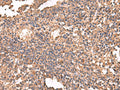 LDHAL6B Polyclonal Antibody – Figure 1 of 2