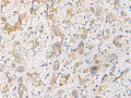 FYCO1 Polyclonal Antibody – Figure 1 of 3