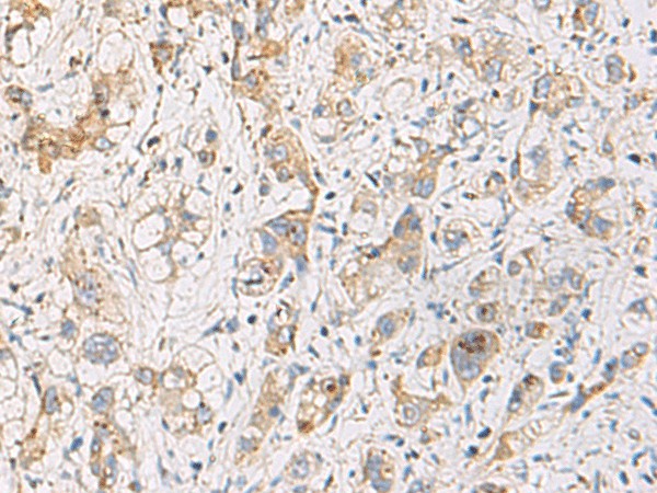 FYCO1 Polyclonal Antibody – Figure 1 of 3