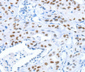 ARID1A Polyclonal Antibody – Figure 1 of 3