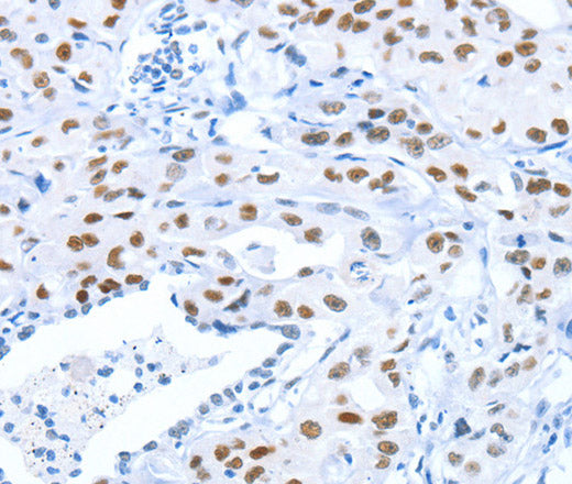 ARID1A Polyclonal Antibody – Figure 1 of 3