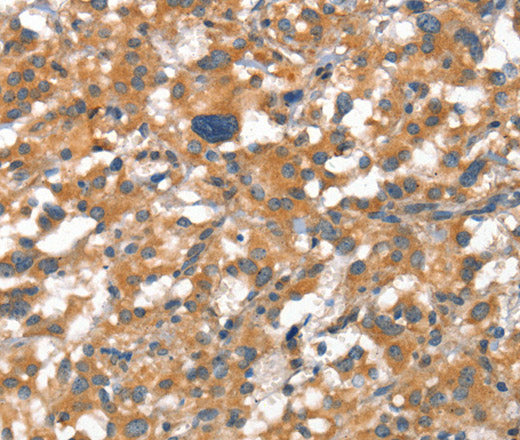 VE-Cadherin Polyclonal Antibody – Figure 1 of 3