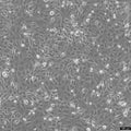 Hs 578T cell