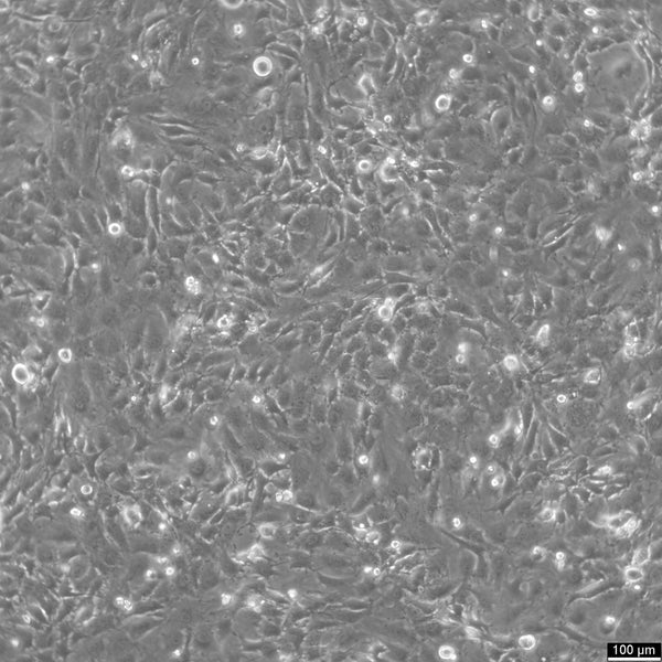 Hs 578T cell