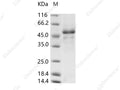 Recombinant Rift Valley fever virus (RVFV) (strain MP12) Glycoprotein G1 Protein (His Tag) - Figure 1 of 2