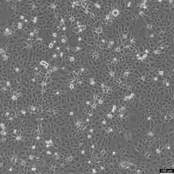 HuCC-T1 cell