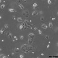 HuH-6 cell