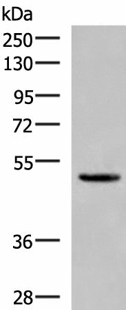 PSMD12 Polyclonal Antibody – Figure 1 of 4