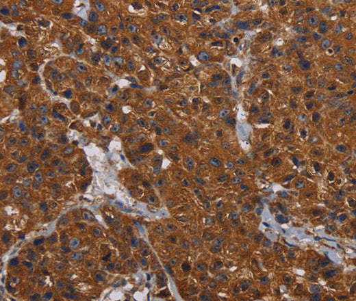 HYAL2 Polyclonal Antibody – Figure 1 of 3