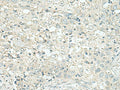 DENND6A Polyclonal Antibody – Figure 1 of 3