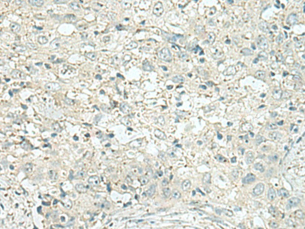 DENND6A Polyclonal Antibody – Figure 1 of 3