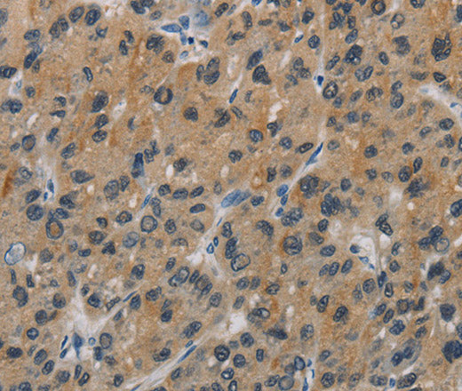 CASP9 Polyclonal Antibody – Figure 1 of 3