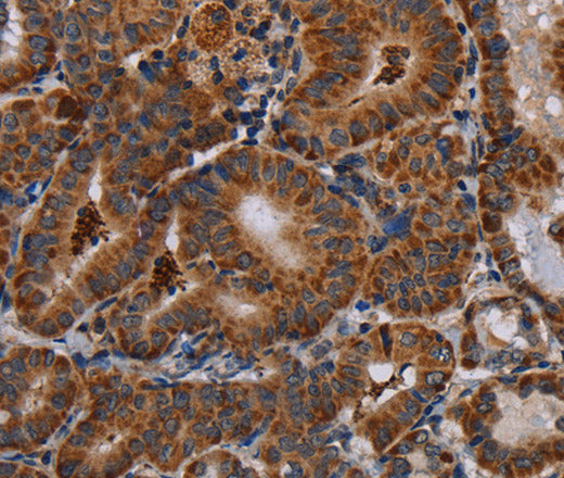 DISC1 Polyclonal Antibody – Figure 1 of 3
