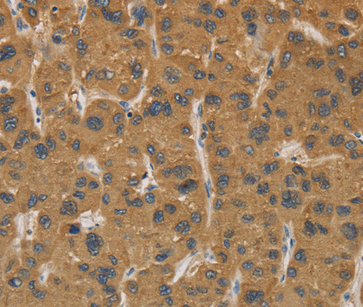 CYP17A1 Polyclonal Antibody – Figure 1 of 3