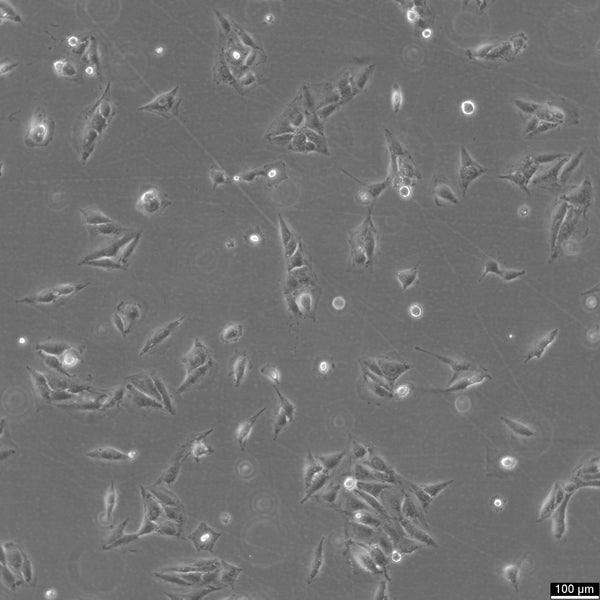 IBRS-2 cell