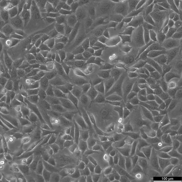 ID8 cell