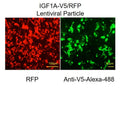 IGF1A ORF cDNA Lentivirus – Figure 1 of 1