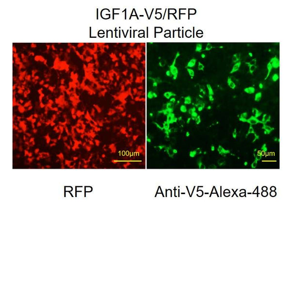 IGF1A ORF cDNA Lentivirus – Figure 1 of 1