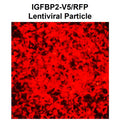 IGFBP2 ORF cDNA Lentivirus – Figure 1 of 1