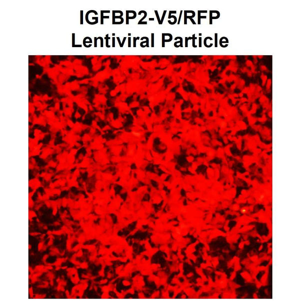 IGFBP2 ORF cDNA Lentivirus – Figure 1 of 1