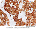 SensiStain™ Anti-Cytokeratin 7 Antibody – Figure 1 of 1
