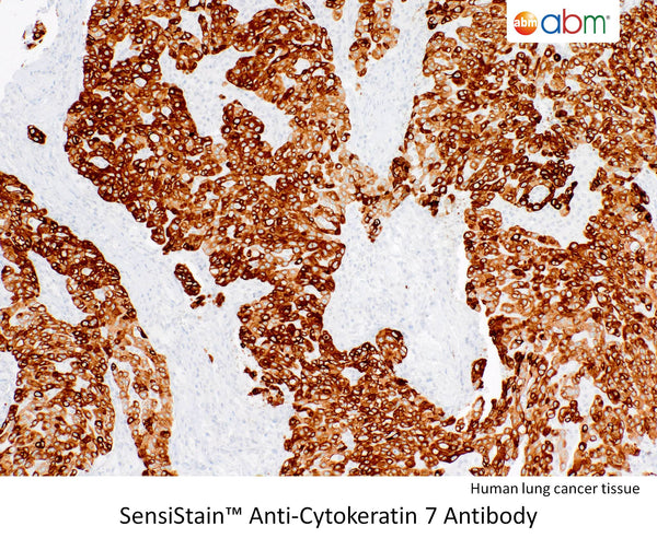 SensiStain™ Anti-Cytokeratin 7 Antibody – Figure 1 of 1