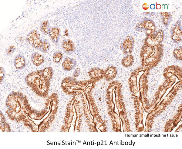 SensiStain™ Anti-p21 Antibody – Figure 1 of 1