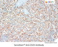 SensiStain™ Anti-CD25 Antibody – Figure 1 of 1
