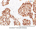 SensiStain™ Anti-p40 Antibody – Figure 1 of 1