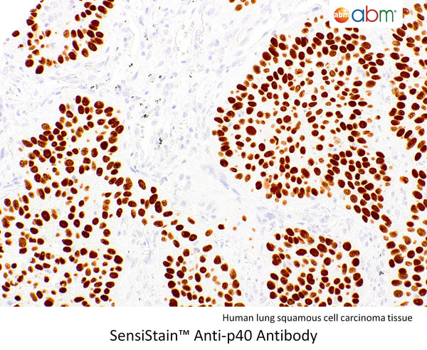 SensiStain™ Anti-p40 Antibody – Figure 1 of 1