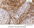 SensiStain™ Anti-ZAP70 Antibody – Figure 1 of 1