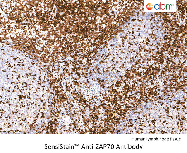 SensiStain™ Anti-ZAP70 Antibody – Figure 1 of 1