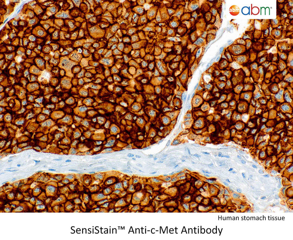 SensiStain™ Anti-c-Met Antibody – Figure 1 of 1