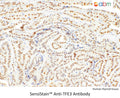 SensiStain™ Anti-TFE3 Antibody – Figure 1 of 1