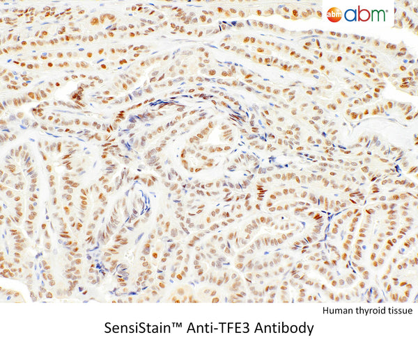 SensiStain™ Anti-TFE3 Antibody – Figure 1 of 1