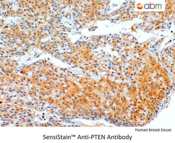 SensiStain™ Anti-PTEN Antibody – Figure 1 of 1