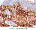 SensiStain™ Anti-MCT4 Antibody – Figure 1 of 1