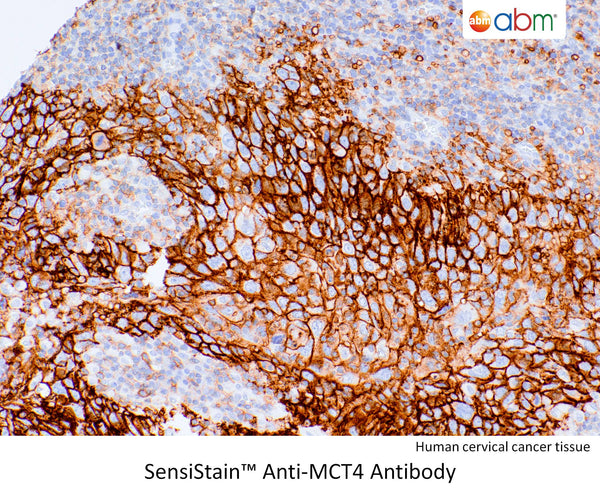SensiStain™ Anti-MCT4 Antibody – Figure 1 of 1