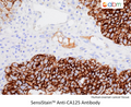 SensiStain™ Anti-CA125 Antibody – Figure 1 of 1