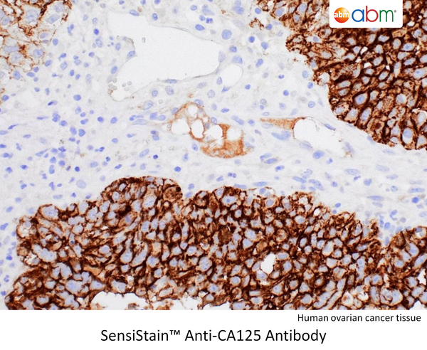 SensiStain™ Anti-CA125 Antibody – Figure 1 of 1