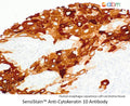 SensiStain™ Anti-Cytokeratin 10 Antibody – Figure 1 of 1