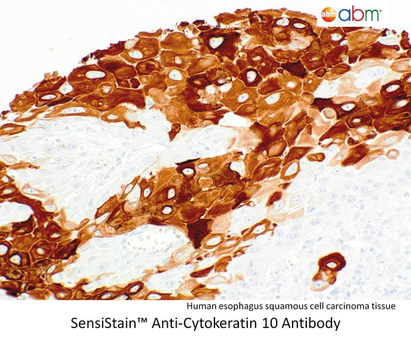 SensiStain™ Anti-Cytokeratin 10 Antibody – Figure 1 of 1